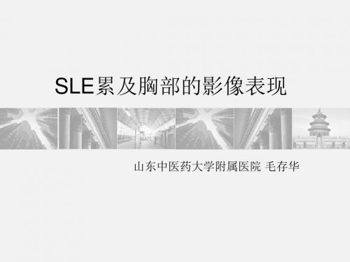 sle累及胸部的影像表现-讲课版