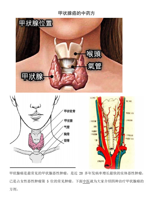 甲状腺癌的中药方