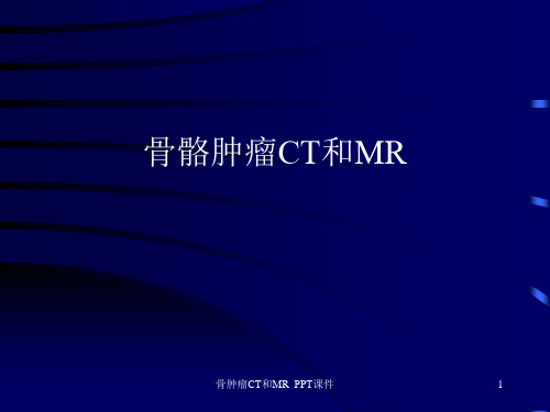 骨肿瘤CT和MR ppt课件