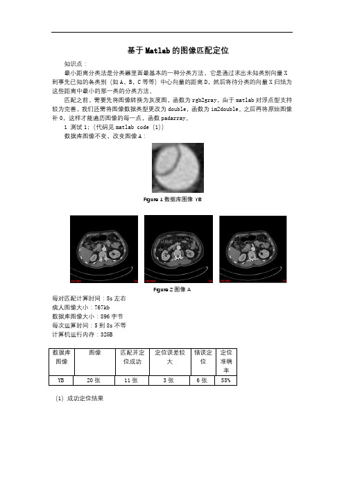 基于Matlab的图像特征识别及匹配