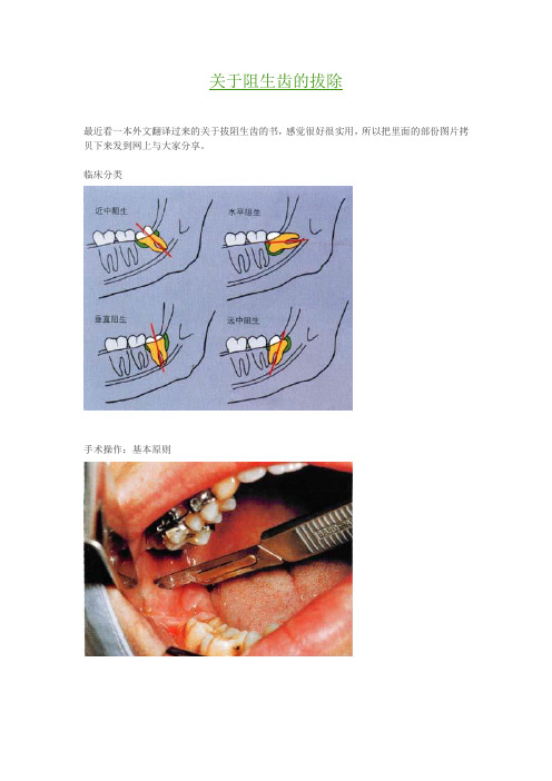 关于阻生齿的拔除