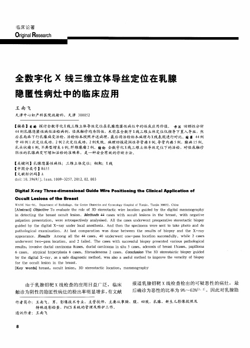 全数字化X线三维立体导丝定位在乳腺隐匿性病灶中的临床应用