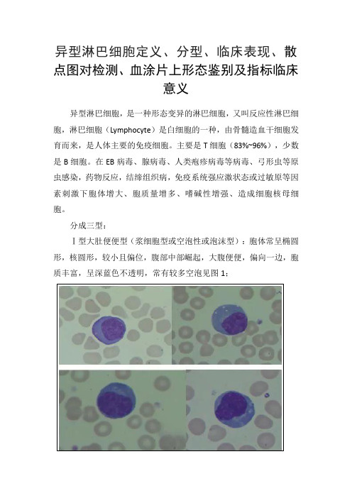 异型淋巴细胞定义、分型、临床表现、散点图对检测、血涂片上形态鉴别及指标临床意义