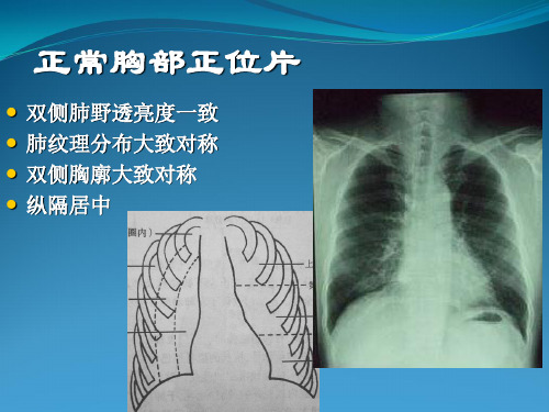 2015临床执业医师实践技能考试影像学(X线、CT、B超)精讲