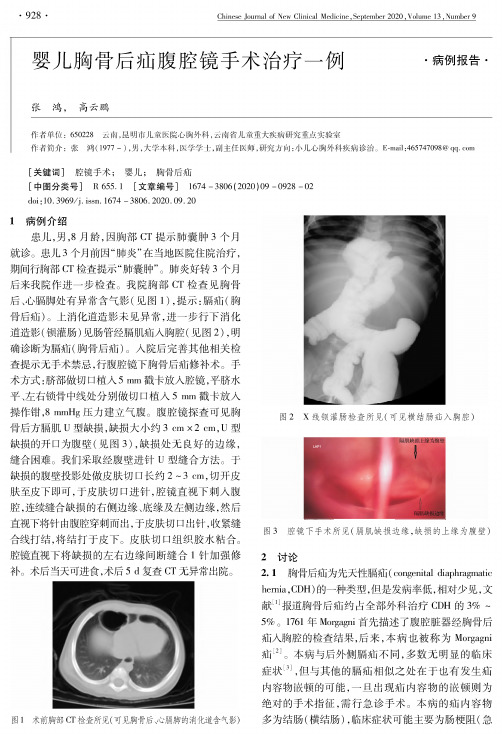 婴儿胸骨后疝腹腔镜手术治疗一例