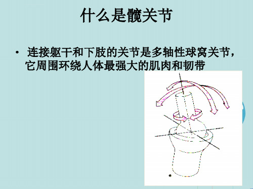 人工髋关节置换术的护理PPT课件