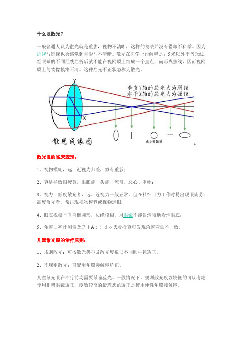 什么是散光