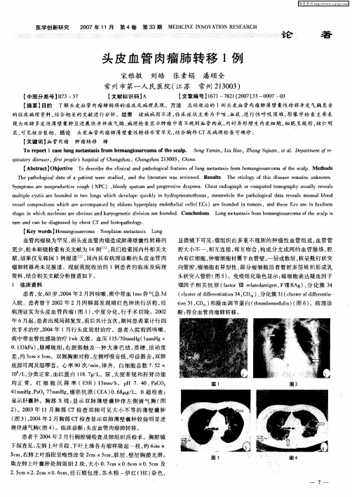 头皮血管肉瘤肺转移1例