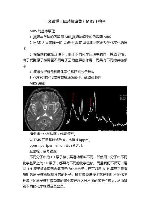 一文读懂！磁共振波普（MRS）检查