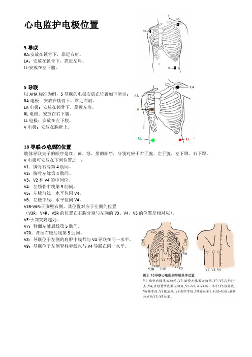 心电图、心电监护电极位置