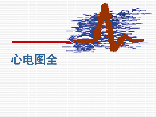 心电图全 ppt课件