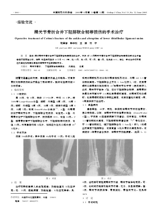 踝关节骨折合并下胫腓联合韧带损伤的手术治疗