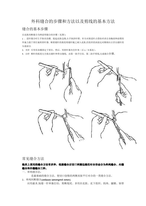 外科缝合的步骤和方法以及剪线的基本方法