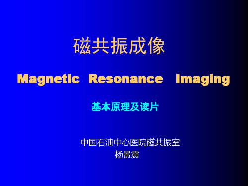 核磁共振MRI 基本原理及读片