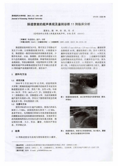 肠道憩室的超声表现及鉴别诊断11例临床分析