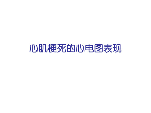 心肌梗死的心电图表现