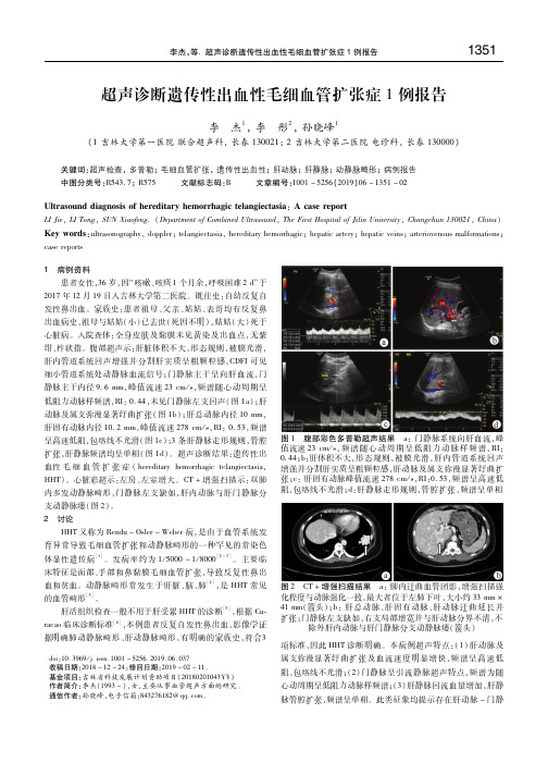 超声诊断遗传性出血性毛细血管扩张症1例报告