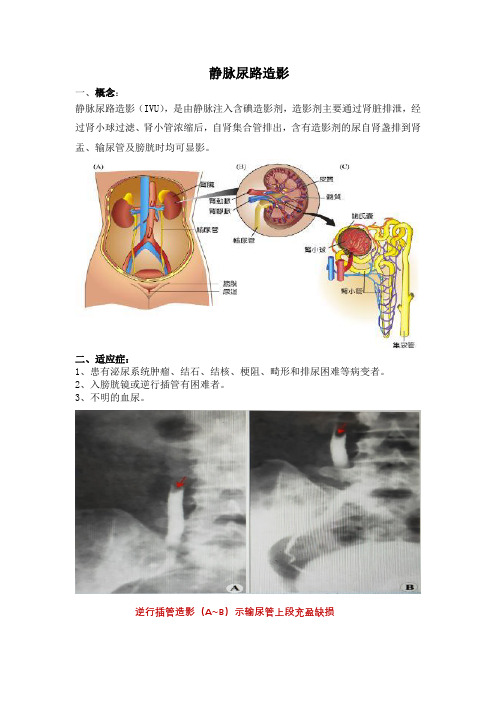 静脉肾盂造影健康教育