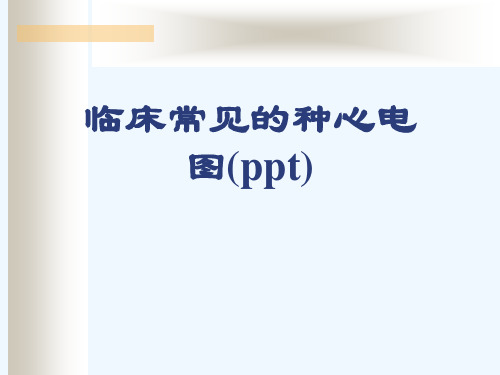 临床常见的种心电图(ppt)