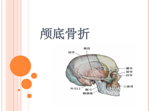 颅底骨折护理标准