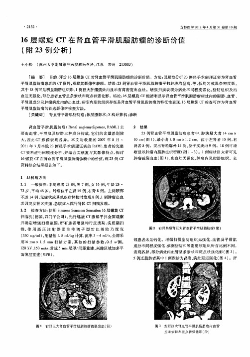 16层螺旋CT在肾血管平滑肌脂肪瘤的诊断价值(附23例分析)