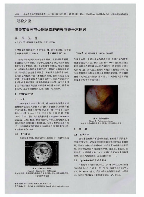 膝关节骨关节炎腘窝囊肿的关节镜手术探讨