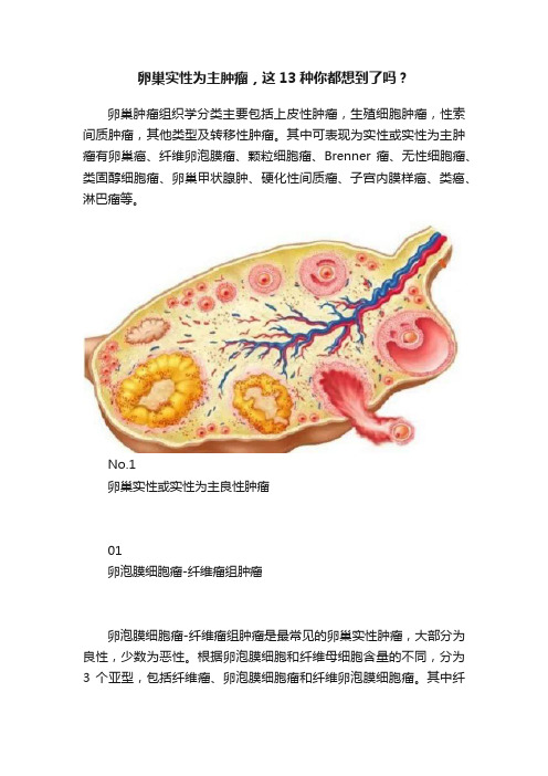 卵巢实性为主肿瘤，这13种你都想到了吗？