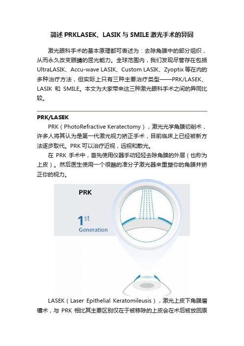 简述PRKLASEK、LASIK与SMILE激光手术的异同