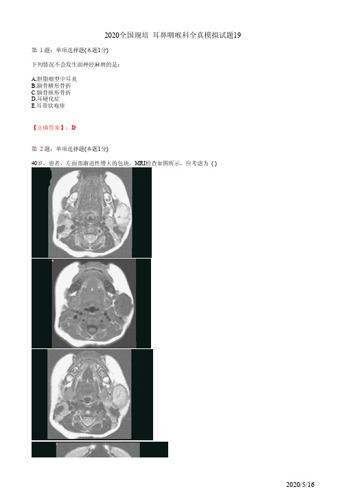 耳鼻喉住院医师规培习题19(题+答案)