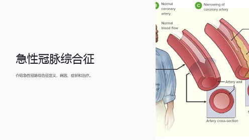 急性冠脉综合征指南课件