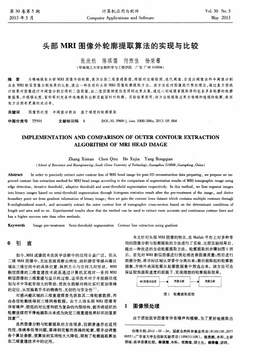 头部MRI图像外轮廓提取算法的实现与比较