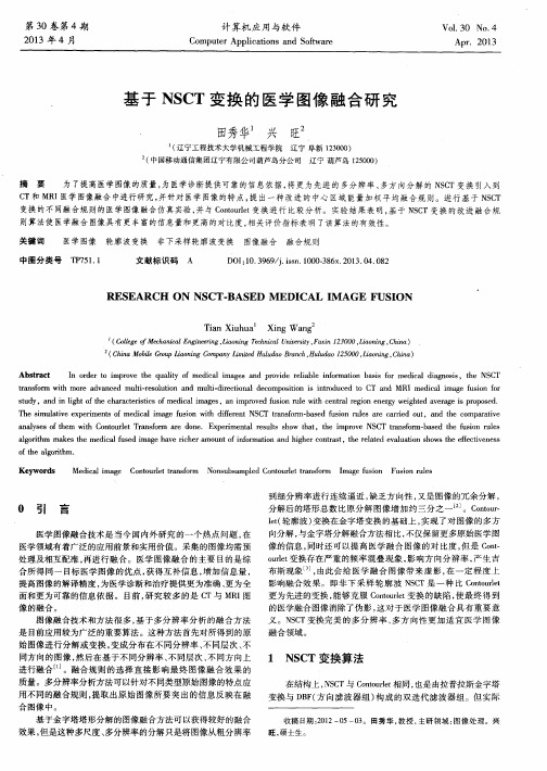 基于NSCT变换的医学图像融合研究