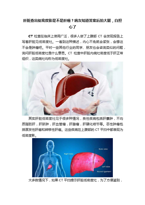 肝脏查出低密度影是不是肝癌？病友知道答案后拍大腿，白担心了