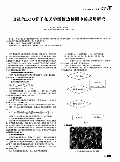 改进的LOG算子在医学图像边检测中的应用研究