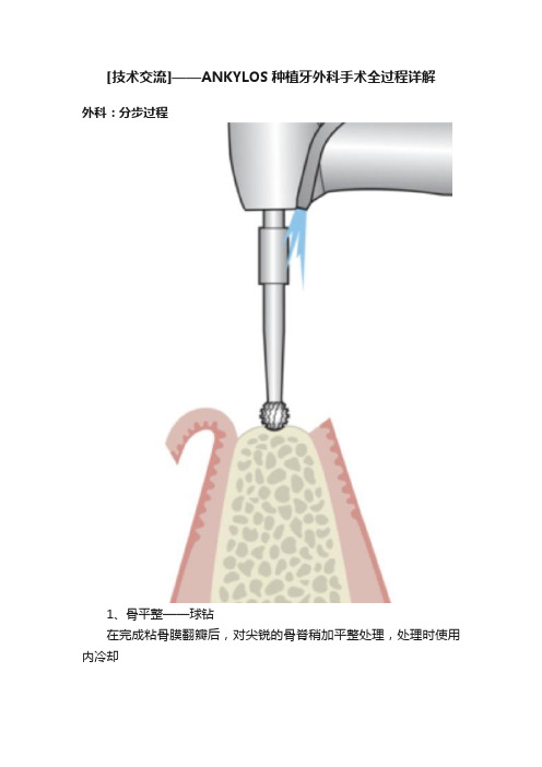 [技术交流]——ANKYLOS种植牙外科手术全过程详解