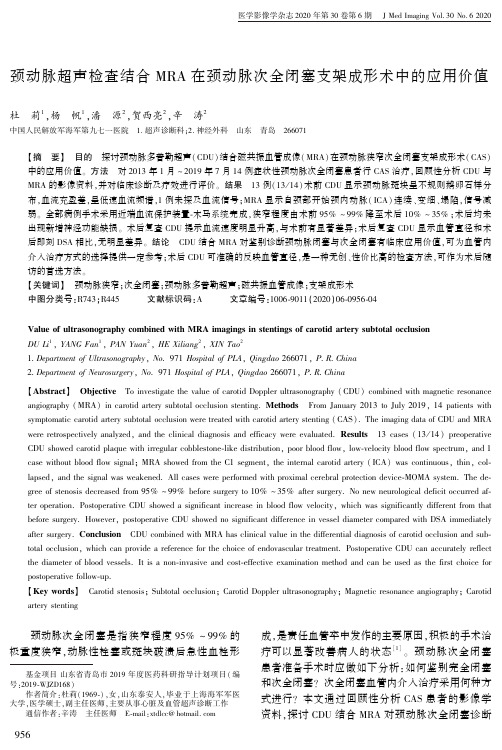 颈动脉超声检查结合MRA在颈动脉次全闭塞支架成形术中的应用价值