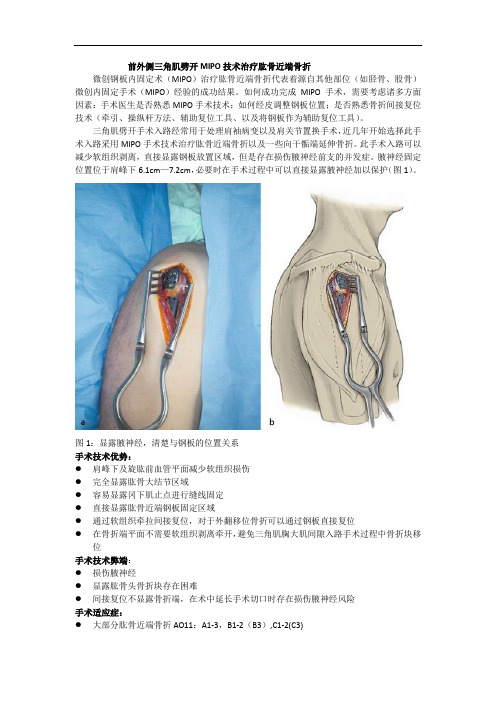 前外侧三角肌劈开MIPO技术治疗肱骨近端骨折讲解