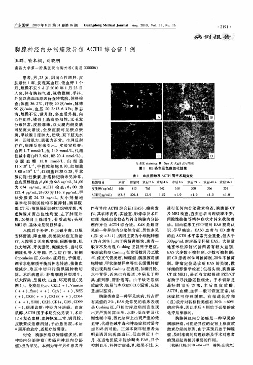 胸腺神经内分泌癌致异位ACTH综合征1例