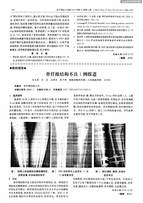 骨纤维结构不良1例报道