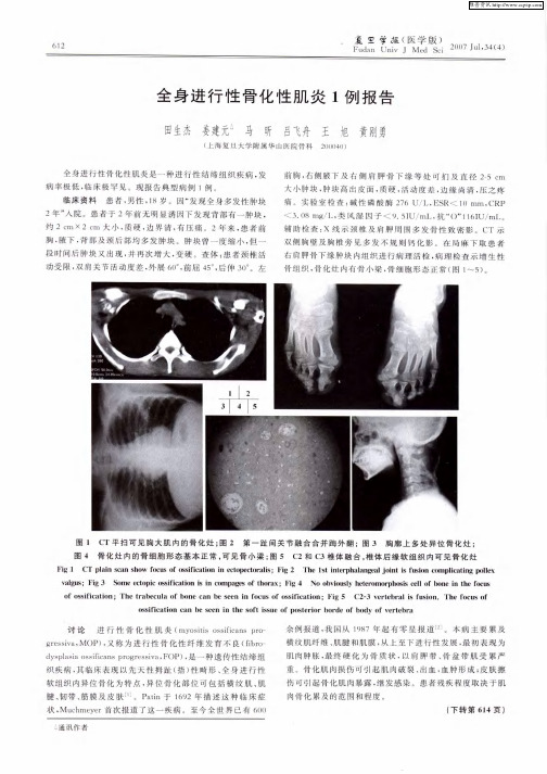 全身进行性骨化性肌炎1例报告