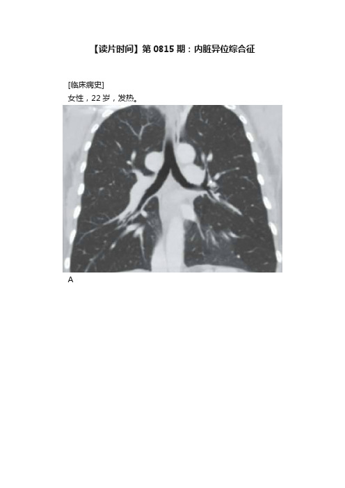 【读片时间】第0815期：内脏异位综合征