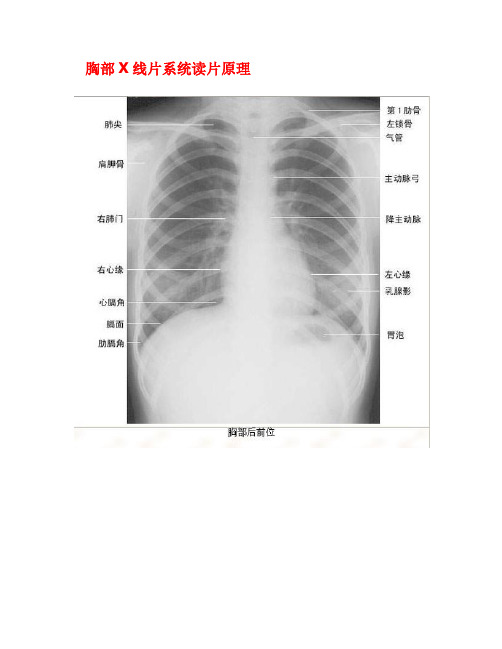 临床医生看胸部X线片系统读片原理