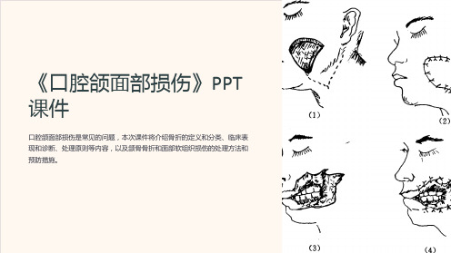 《口腔颌面部损伤》课件