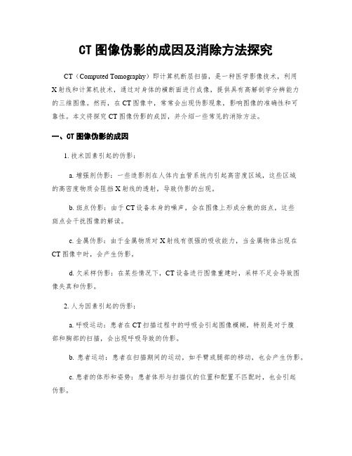 CT图像伪影的成因及消除方法探究