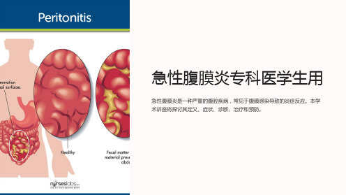 急性腹膜炎专科医学生用