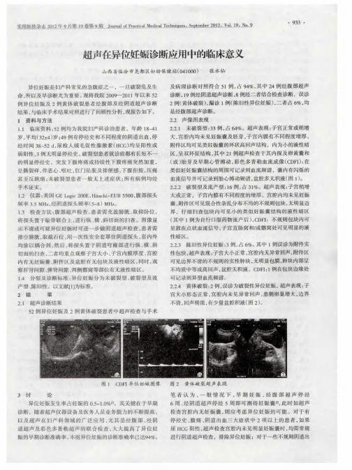 超声在异位妊娠诊断应用中的临床意义