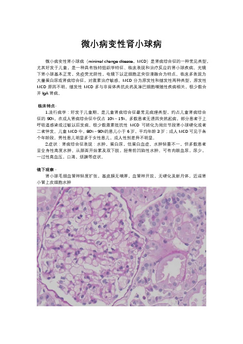 微小病变性肾小球病