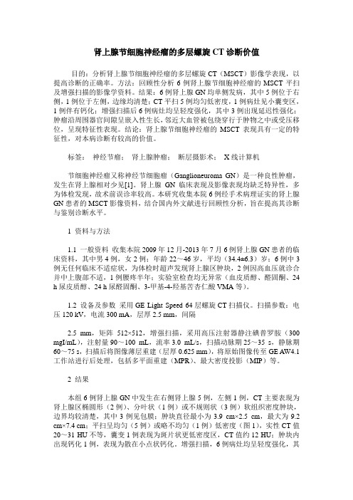肾上腺节细胞神经瘤的多层螺旋CT诊断价值