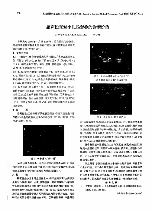 超声检查对小儿肠套叠的诊断价值