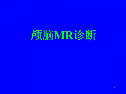 颅脑MR诊断